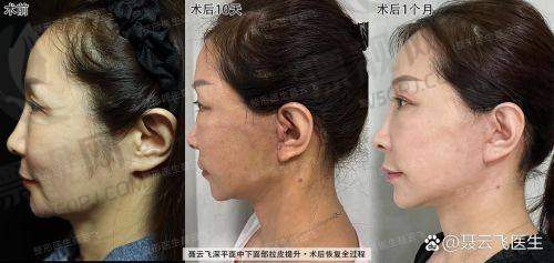 北京加减美医疗美容院长是谁？