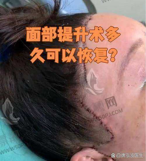 北京加减美医疗美容院长是谁？揭秘这家医院正规性、面部提升效果及美容 v6、v9 价格！