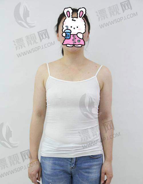 傲诺拉假体有几个系列？价格多少？优势在哪？带你深入了解傲诺拉假体隆胸！