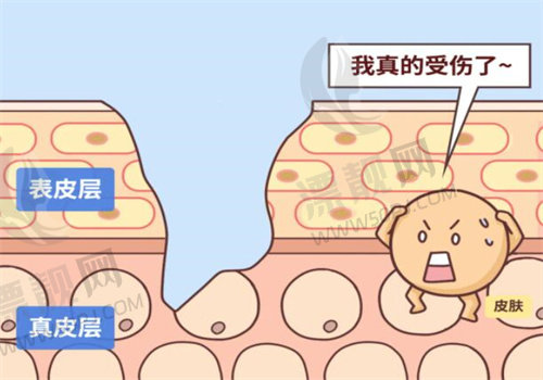 成都做手术祛疤哪家医院做的好，十大祛疤医院详细对比攻略