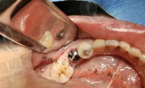 4. 长沙瑞泰科尔雅口腔