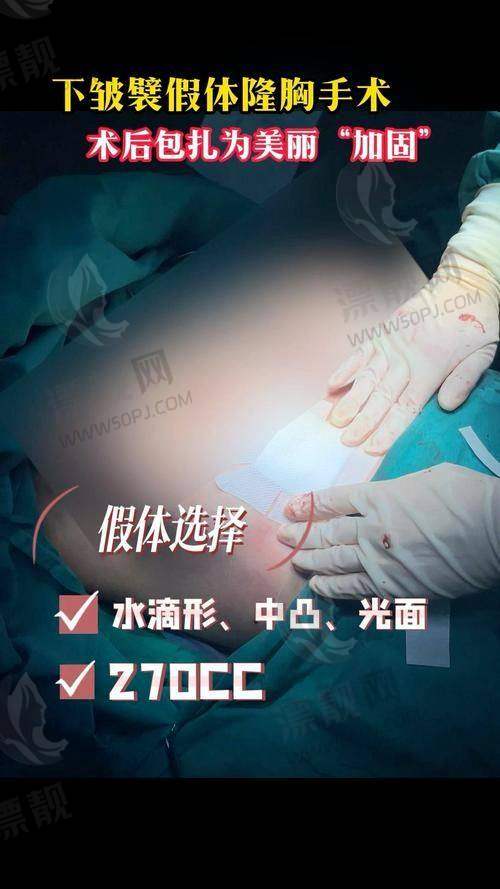 不同地区的医美机构与傲诺拉假体隆胸