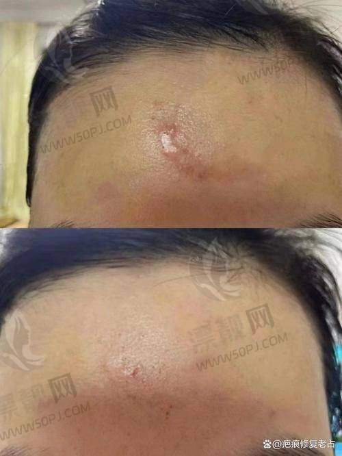 成都新丽美医院皮肤中心