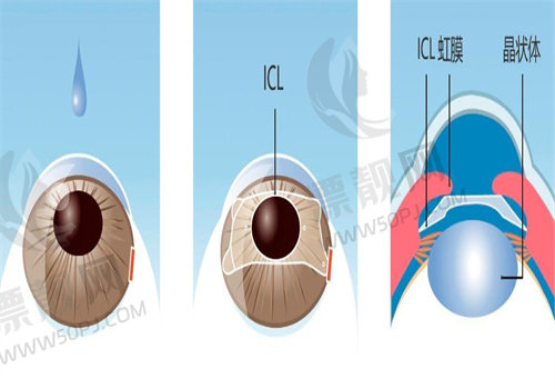 郑州视光眼科医院做近视手术怎么样，各项优势与价格对比一目了然！