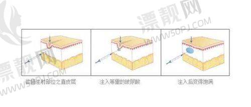 上海美莱医疗美容医院：胸部整形“动感派”的代表