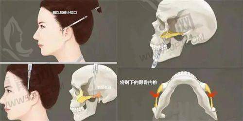 上海薇琳医疗美容医院
