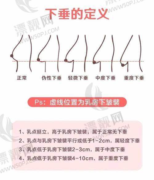 一文看懂傲诺拉假体：好不好值不值，关键看你怎么看