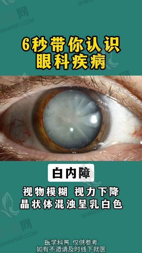 飞秒激光手术：新视界 VS 华厦 VS 爱尔，该选谁？数据告诉你！