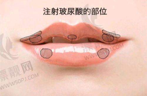 加盟支持详情