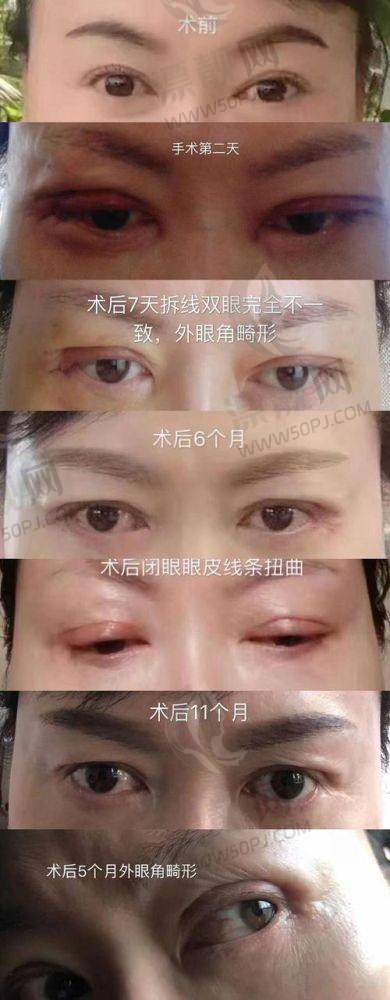 四、为啥北京米兰柏羽丽都的眼部技术值得“成为回头客”？