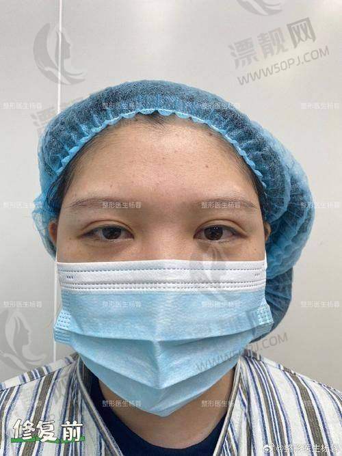 三、北京米兰柏羽丽都做眼部项目贵吗？网友实名吐槽价格套路和避坑指南！