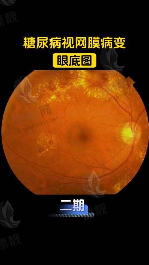 银川市眼科医院排名榜?爱尔眼科、华夏眼科、普瑞技术好