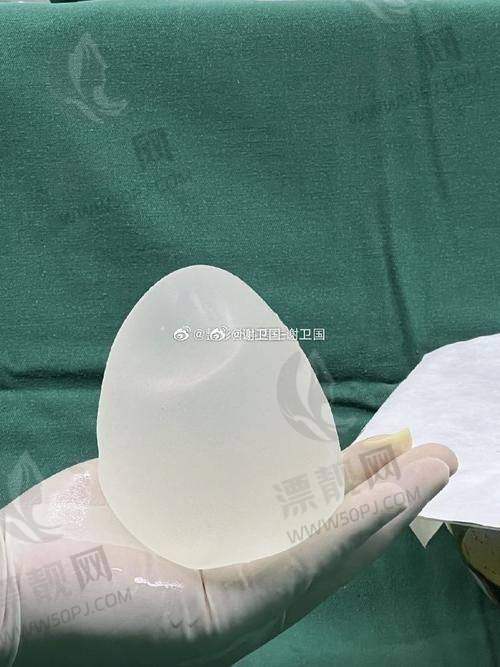 想了解假体隆胸傲诺拉价格、大小对比、特点及防调包方法？星熠光面优势与变软时间全揭秘！