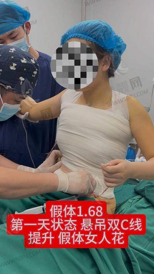傲诺拉假体的优势分析