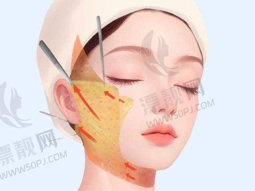 私立连锁的“公有级”品控
