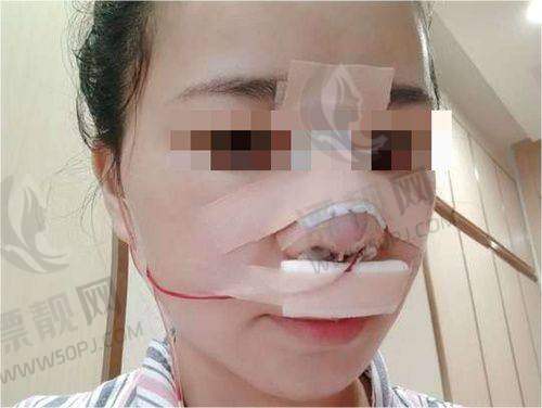 广州佳人医疗美容整形门诊部眼部整形、抗衰老、去黑眼圈等项目价格优惠,速来体验