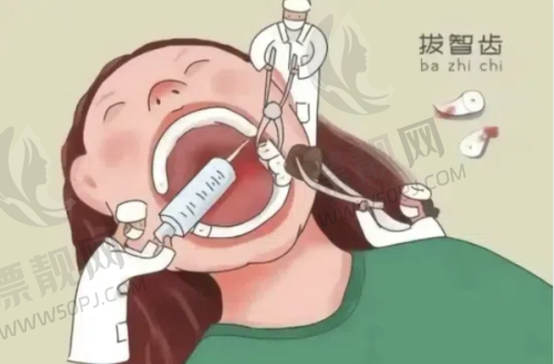 如何根据自身情况选择拔牙地点?