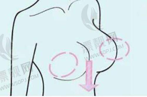 热门医美项目