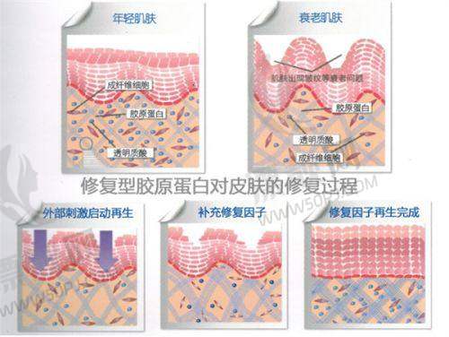 南京维昕时尚医疗美容诊所玻尿酸丰唇1800元起、双眼皮2500元起等项目价格实惠
