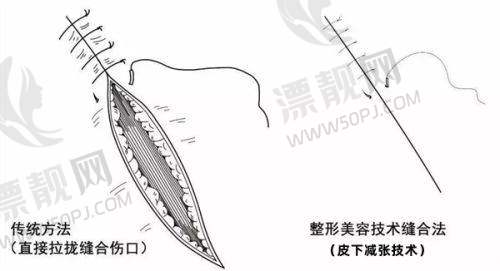 其他相关医美项目