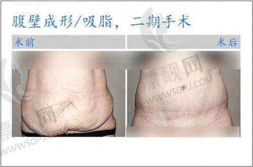 内部环境