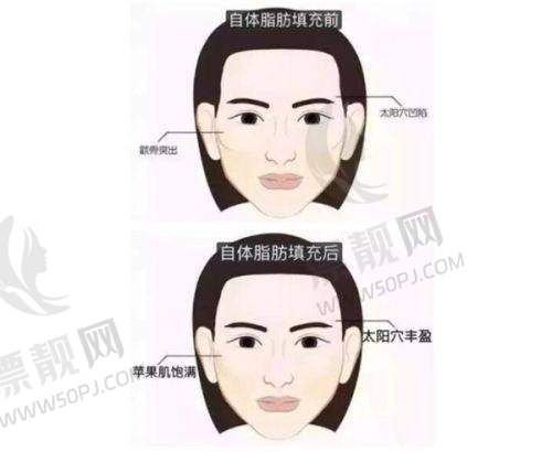 广州荔湾区人民医院医美项目价格大公开!奥美定取出8000 - 50000元,双眼皮3000 - 6000元
