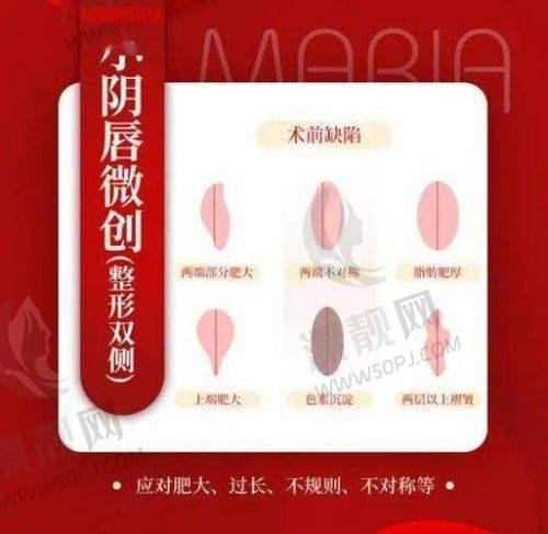 附带小彩蛋:私密整形适合谁?