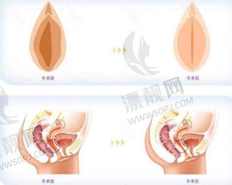 2. 中山爱汇星医疗美容医院