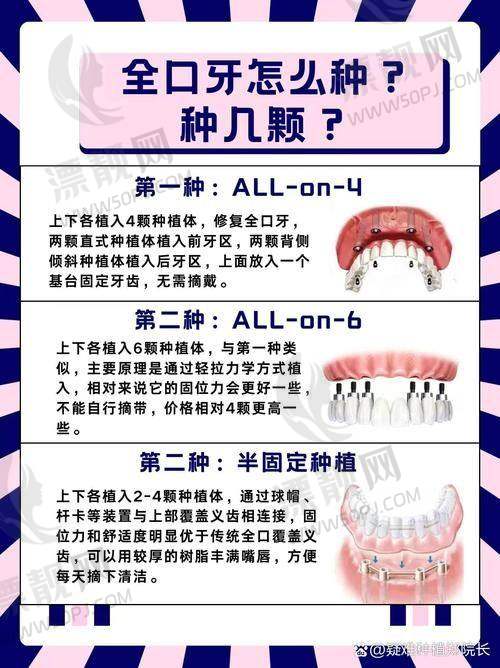 广州柏德口腔的消毒标准堪比手术室