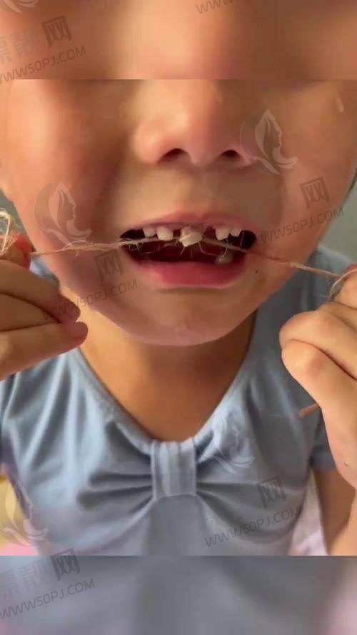 结语:博白拔牙不是难题,选择合适就是关键!