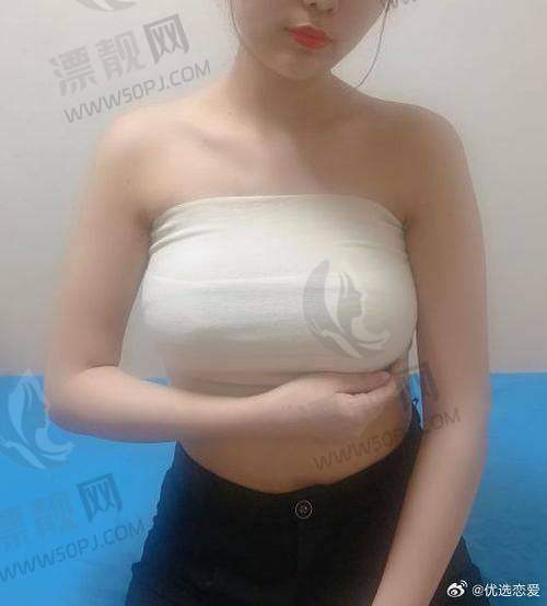 傲诺拉假体有几个系列?