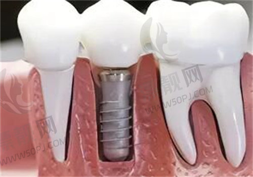 嘉兴圣禾口腔看牙体验口碑好,擅长项目、手术价格、预约挂号方式都一一列出