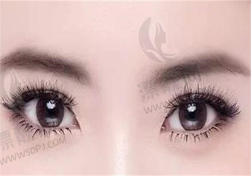 2025 谭敏峰坐诊医院动态澄清:多医院坐诊详情、预约方式及眼修复项目价格曝光