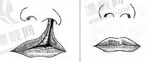 上海玫瑰医疗美容医院——浪漫变得更美之旅