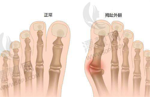 上海新星医疗美容整形外科:自然派代表,术后闭眼如初