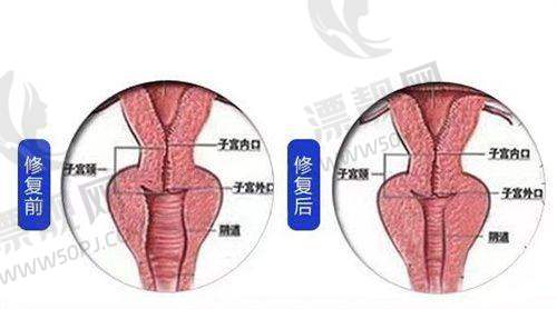 北京嘉禾整形医院是正规医院吗?资质可靠吗?