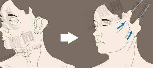 北京嘉禾整形价格大公开:看完别哭