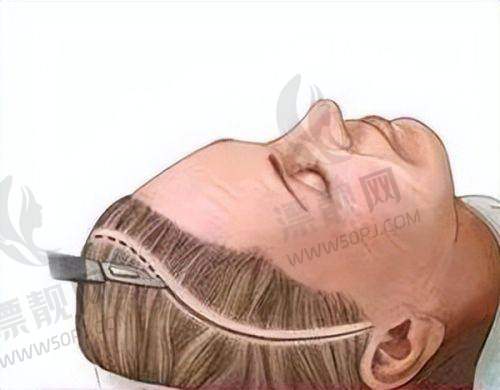 口碑旋风:北京嘉禾整形评价汇总,侯智慧院长获赞