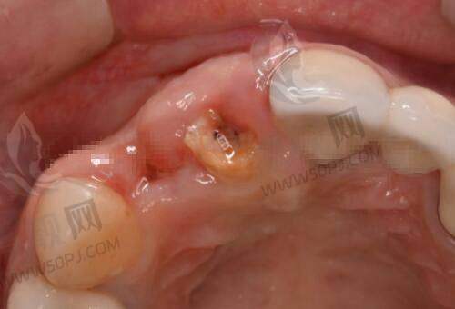 侯智慧医生带你飞:北京嘉禾医美价格与优势全解析