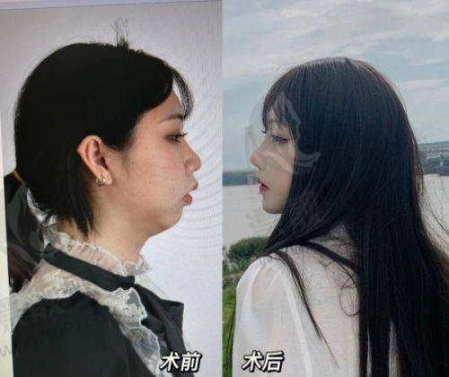 上海市医美医院哪个好?揭秘上海比较好的医美医院及出名项目,速来了解!