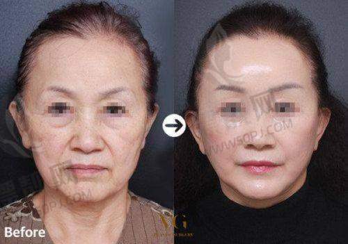 上海市医美24小时咨询热线,为你揭秘上海医美整形医院地址电话及医美医院真实情况!