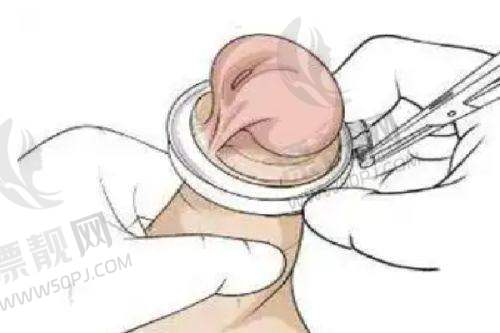 北京嘉禾整形王牌项目亮点解析