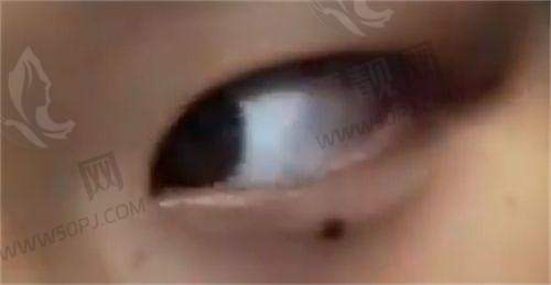 北京嘉禾整形医院的侯智慧院长深度剖析:他的拿手好戏是什么?