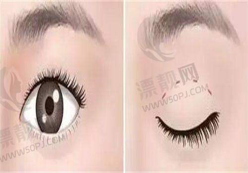 北京嘉禾整形是公立医院还是私立医院啊?北京嘉禾医美整形医院怎么样,是正规医院吗?