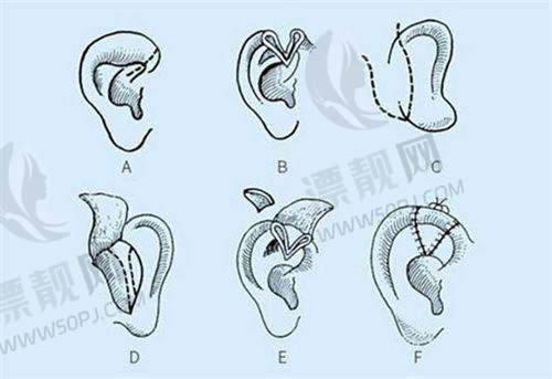 北京嘉禾整形医院的其他相关信息:全方面了解