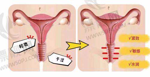 真人实例分享:北京嘉禾整形改变人生