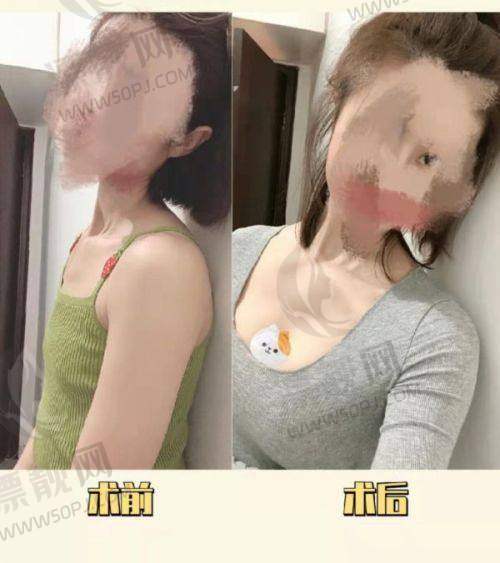 为什么说傲诺拉“稳”?抗下垂、抗位移,它真的行!