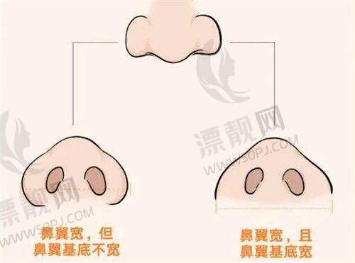 北京嘉禾整形综合指南:地铁、价格、医生一网打尽