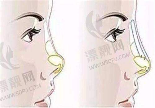 上海伊莱美医疗美容医院：专精变得更美的“秘密基地”