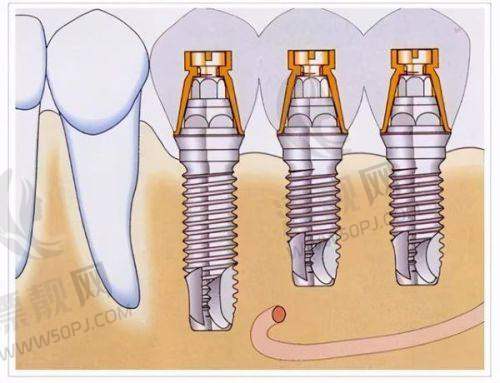 结语：看牙别云里雾里，来圣禾一步到位！